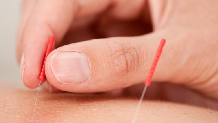 視神經萎縮的癥狀是什么 中醫針灸治療視神經萎縮有奇效