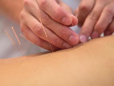 癌癥的針灸治療有什么作用 中醫針灸療法抗癌的特點和優勢