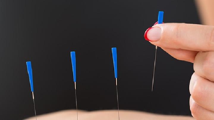 中醫(yī)針灸治療痛經(jīng)效果好嗎 中醫(yī)針灸治療痛經(jīng)需了解三方面