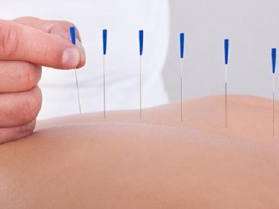 發(fā)現(xiàn)中風(fēng)后如何選擇就醫(yī)? 中醫(yī)針灸對治療中風(fēng)的作用介紹