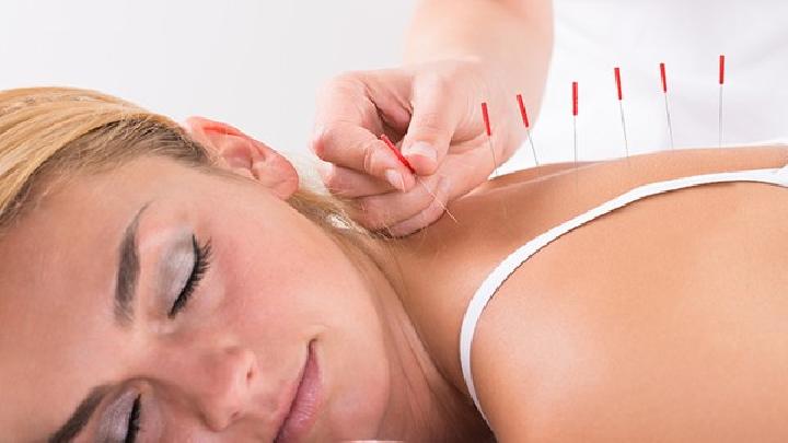 中醫針灸能治療痛經嗎 中醫針灸治療痛經的4個方法