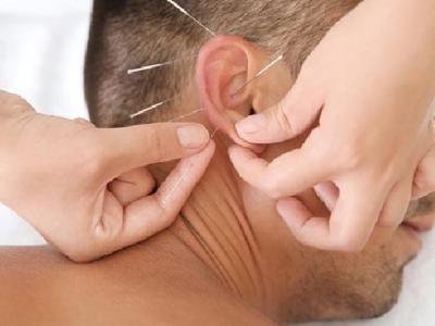 中醫怎么運用穴位針灸治療痤瘡 中醫針灸治療痤瘡的兩個方面