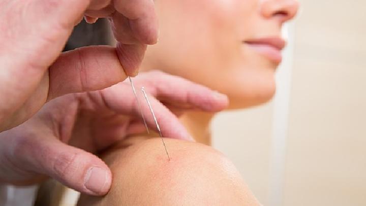 女性原發(fā)性痛經(jīng)怎么治療比較好  中醫(yī)針灸治療原發(fā)性痛經(jīng)效果顯著