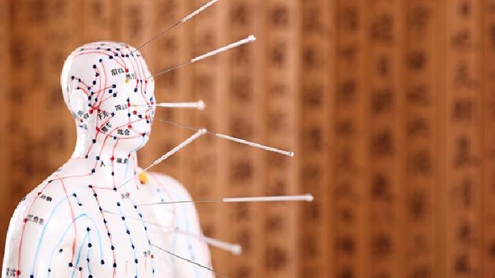 女性閉經(jīng)的癥狀有哪些 女性遠(yuǎn)離閉經(jīng)試試針灸療法