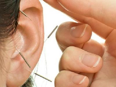 中醫(yī)針灸減肥都存在什么誤區(qū) 中醫(yī)針灸減肥五大誤區(qū)要注意