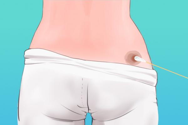 蒲團坐灸的危害