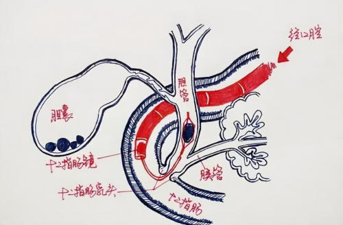十一代中醫于海燕：探秘壯血藥酒與中醫智慧，守護健康之道