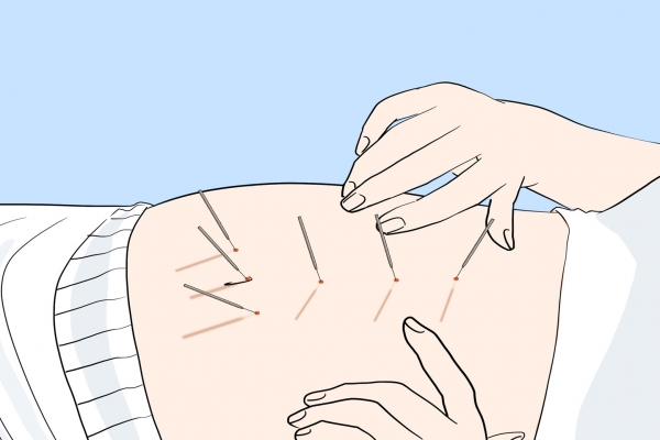 三九灸時(shí)間